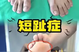 短趾延长，#足部护理 #医学科普 #一起来锻炼 #居家锻炼 #富贵包 康主任是绝对的权威视频封面