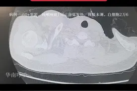 #医学影像 #呼吸影像 次日发结果，择日随缘讲解（如果有要求讲解的话）