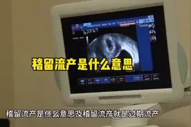 稽留流产是什么意思？稽留流产就是过期流产视频封面