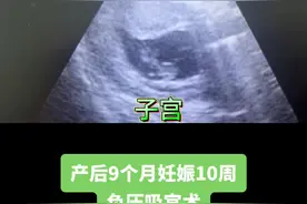 #怀孕 #医学科普 #无痛人流手术视频封面