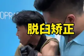 脱臼复位的过程看起来就很痛 #脱臼 #骨折 #人体结构视频封面