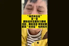 眼周发黑，色素沉着也是梅杰综合征的临床表现#梅杰综合征 #眼睑痉挛 #肌张力障碍 #齐鲁医院梅杰综合征马翔宇视频封面