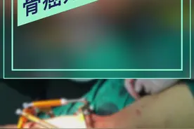 患了骨癌该如何治疗？#医学科普 #肿瘤 #兔年开工健康指南