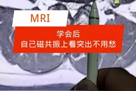学会后自己磁共振上看突出不用愁#腰椎 #腰椎间盘突出 #腰疼腿疼视频封面