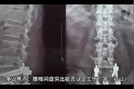 #腰椎间盘突出能否获得工伤认定视频封面