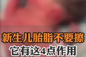新生儿胎脂不要擦，它有这4点作用#医学科普 #硬核健康科普行动 #新生儿 #胎脂视频封面