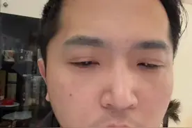 孩子有痣不用太担心，但是这个额头露和不露出来完全两个世界了！ #额头 #痣 #露额头视频封面