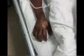 很多人不懂毒性，难免会紧张害怕，给予最好建议和安慰，好人一生平安，你忘记点赞了吗哈哈哈哈#原矛头蝮咬伤视频封面