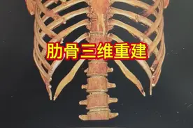 肋骨三维重建 肋骨三维重建，好逼真视频封面