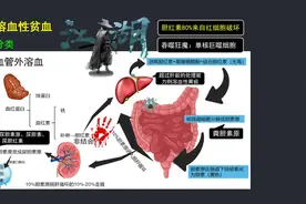 考研速记:血管外溶血 #医学生 #临床医学#医学考研视频封面