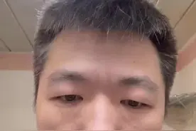 （1/2）眼科医生居然得了红眼病？红眼病该如何处理？眼部冷敷怎么做？病毒感染？#眼科 #结膜炎 #眼部护理 #医学科普 #眼科科普视频封面
