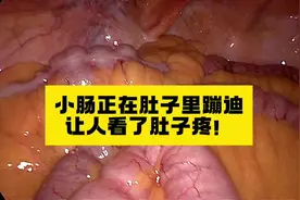 小肠正在蠕动，跟你想象的一样吗？肚子有没有隐隐作痛视频封面