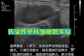 传染性单核细胞增多症超声相关知识学习 传染性单核细胞增多症超声相关知识学习。#医学科普 #超声影像 #超声学习 #传染性单核细胞增多症 #医学小知识 @抖音短视频视频封面