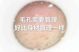 #解决皮肤毛囊堵塞的方法视频封面