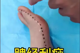 #脾经刮痧 #胃痛胃胀 #小动作大作用视频封面