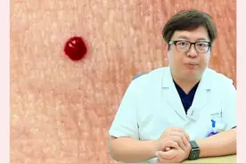 身上着三种红痣，教你如何辨别！ #蜘蛛痣 #紫癜 #红痣 #硬核健康科普行动视频封面