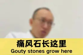 痛风石长这里，风险高几倍！ 痛风石患者的痛风石都长在哪里？什么是痛风石？#痛风石 #痛风 #硬核健康科普行动 #作品同步头条赢激励视频封面