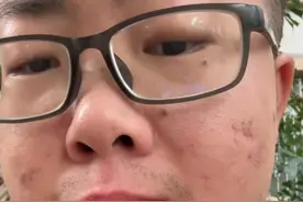 假如每个人每天都消灭一只蚊子，全世界一天就能消灭几十十亿多只蚊子，那以后蚊子会不会被完全消灭呢#蚊子#有趣#给蚊子上一课#基孔肯雅热 #可恶的蚊子