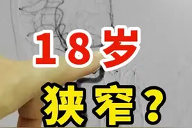 18岁的孩子 双侧大脑中动脉狭窄 #18岁 #头晕 #脑血管狭窄 #医学科普 #硬核健康科普行动视频封面