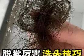 百分之八十的女生洗头都是错❌ 这样洗头脱发更厉害❌ 正确✅洗头方式一定要学习起来#脱发 #洗头的正确方式 #洗头 #掉发 #拯救发际线视频封面