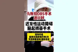 服用抗精神病病史五年，眼睑痉挛，睁眼困难，迟发性运动障碍脑起搏器手术现场开机#迟发性运动障碍 #梅杰综合征 #脑起搏器手术 #DBS手术 #眼睑痉挛视频封面