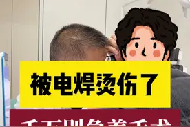 电焊烫伤鼓膜，千万别急着做手术#鼓膜穿孔 #中耳炎 #电焊 #电焊工 #医疗创作者培优计划视频封面
