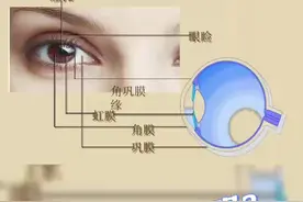 近视也要“忌口”吗？为什么不建议近视的人吃甜食#科普#近视忌口#健康五华视频封面