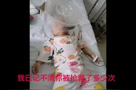#雷特综合征。含泪整理过去，带大家了解雷特综合征视频封面