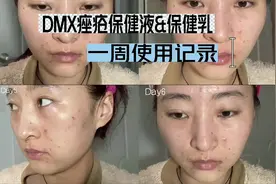 最近被冰寒老师 种草了DMX，迅速也来试试视频封面