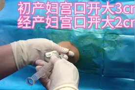 #生孩子打麻醉的针有多长 无痛分娩广大女性的福音视频封面