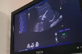 孕23周B超产检图像超清晰，宝宝额头很饱满，两个鼻孔看起来好大视频封面