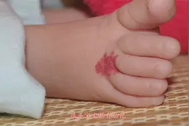 这4个部位有胎记,说明宝宝是富贵命,最后一个财运官运都厉害视频封面