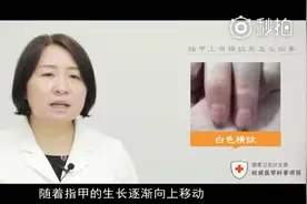 解锁身体密码，指甲上有横纹是怎么回事？听听专家怎么说视频封面