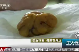 生活圈：杀鸡肚中现“鸡宝”价值数千万，这是真的吗？听专家咋说视频封面