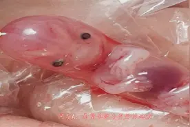 仅60天孕周的胎儿，药流后完整引出的模样，网友：不敢直视视频封面