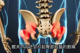 【运动康复科普】胯骨疼痛，你可能是髋关节炎哦视频封面