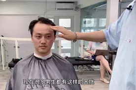 92年男生严重脱发，发际线高的像50岁，改造后变年轻小伙视频封面