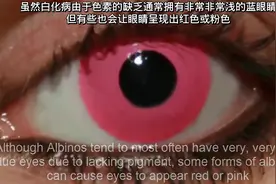 10种极度少见的眼睛瞳孔颜色，尤其是异色瞳和紫罗兰色。视频封面