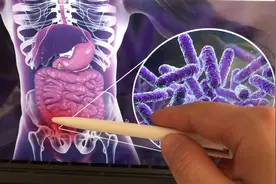 急性阑尾炎的阑尾在肚子哪个地方？阑尾炎一般在哪个部位疼痛！视频封面