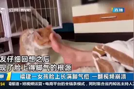 脸上竟能长脚气？福建一女孩脸上长满脚气痘，患病原因却笑翻网友视频封面