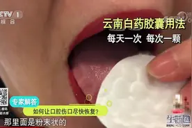 生活圈：舌头不小心被咬伤，我们该如何处理呢？听听专家有何建议视频封面