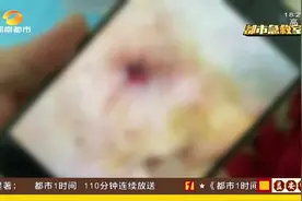 长沙50岁女子意外摔伤，左耳反复流脓，医生检查伤口发现异物！视频封面