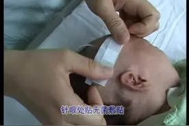 静脉输液法--临床医师技能操作