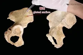 系统解剖学9：下肢骨视频封面