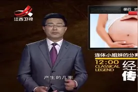 连体小姐的分离奇迹-高清480p视频封面