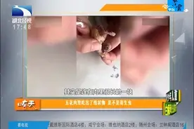 最似是而非的寄生虫，五花肉里吃出了线状物，是不是寄生虫视频封面