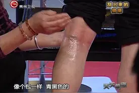 天天健康：腰椎不好？经常拍打这个部位有效缓解，方法超简单视频封面