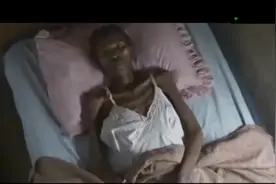 一个艾滋病患者 身体的变化过程 病毒入侵生命太可怕了视频封面