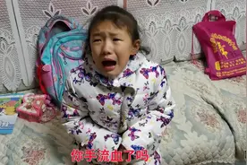 后妈的孩子没人管？看这小女孩哭的这么惨手流多少血？这演技服了视频封面