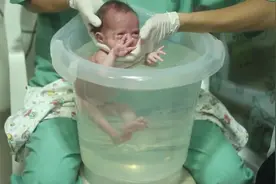 护士用独特的方法给早产儿洗澡，宝宝的肚子好像变大了，好奇怪视频封面